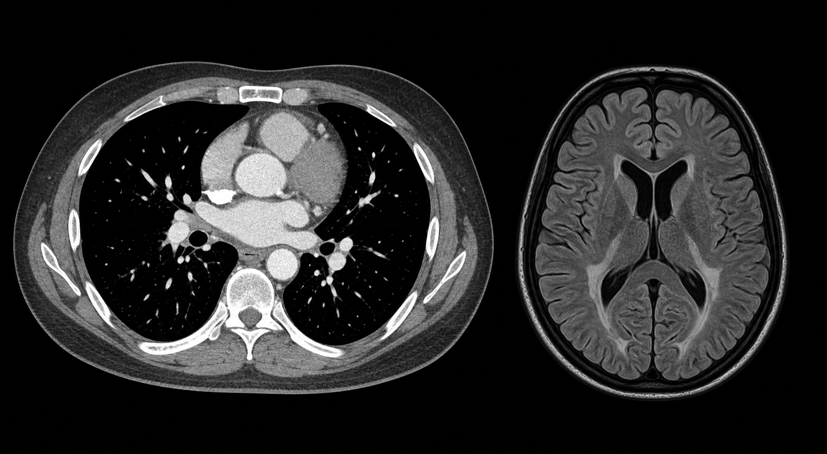 Synthetic educational CT thorax and brain MRI imaging plate